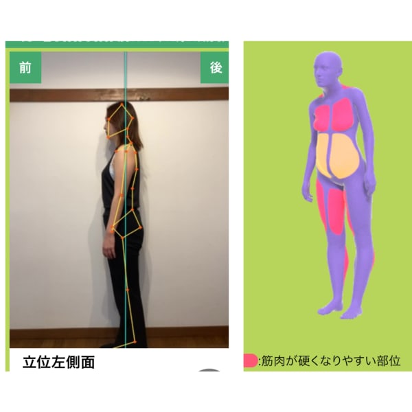 【自分の姿勢、見てみませんか】AI姿勢チェック＆骨盤調整（￥5,500➝￥3,300）