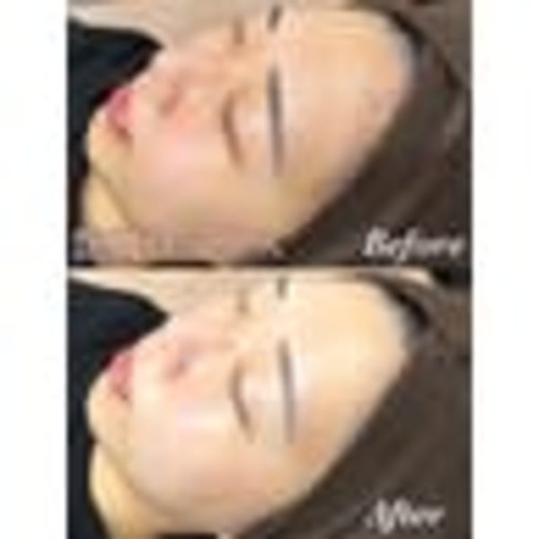 ★男女OK★美肌★艶肌ワックス脱毛