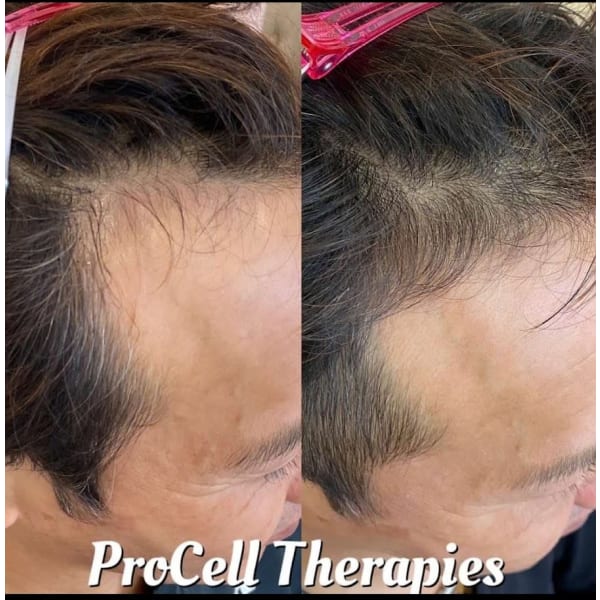 頭皮育毛ヘッドマッサージ60分4,000円