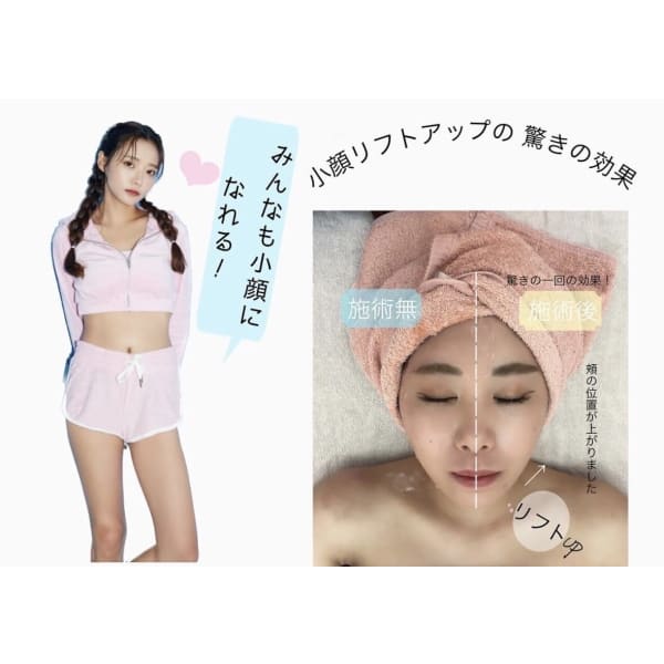 小顔&スベ肌のセット♪毛穴洗浄+小顔リフトアップ+全身脱毛