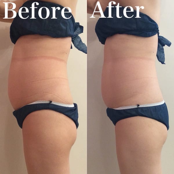 ●医師監修の美やせ痩身●若々しく美しいボディラインに整えながら痩せたい方におススメ