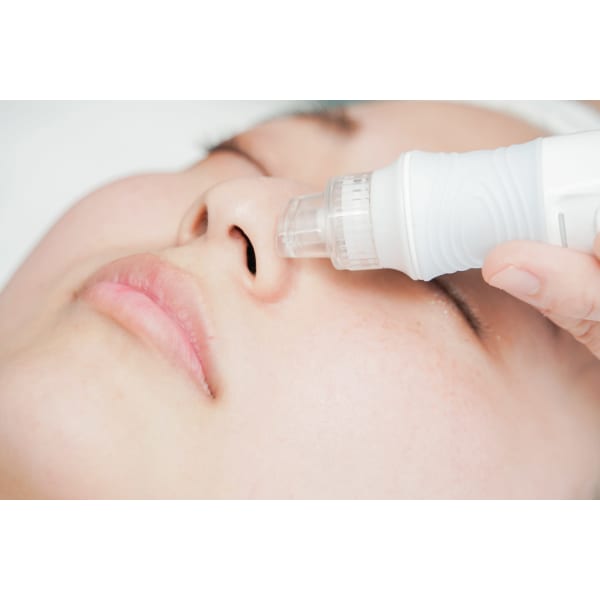 ごっそり毛穴洗浄◎角栓黒ずみ開きにハイドラピーリング ￥4,980