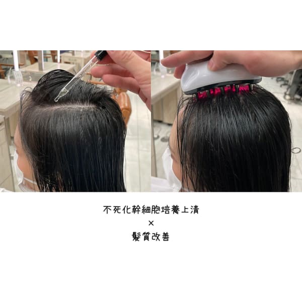 FUSICA整皮トリートメント（不死化幹細胞培養上清液）初回トライアル価格