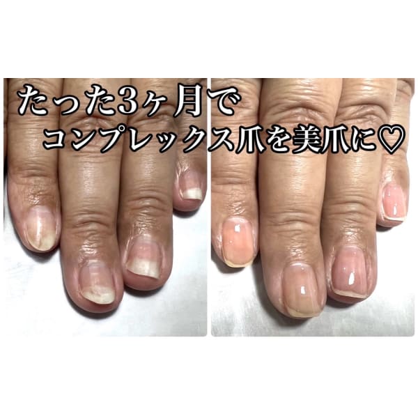 【自爪育成】ネイルケア ～育成コート付～　6,720円 → 5,500円