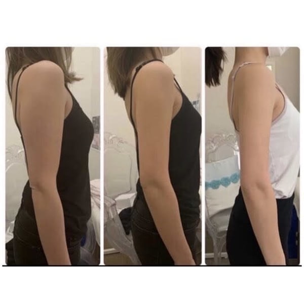 【人気No.1】-12℃脂肪冷却1部位2カップ45分集中施術通常価格18,000→3500円