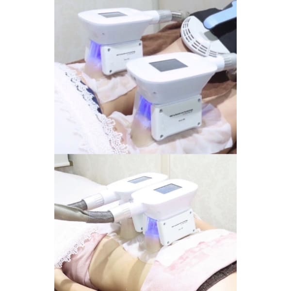 【人気No.2】-12℃脂肪冷却2部位4カップ通常価格36,000円→6,600円