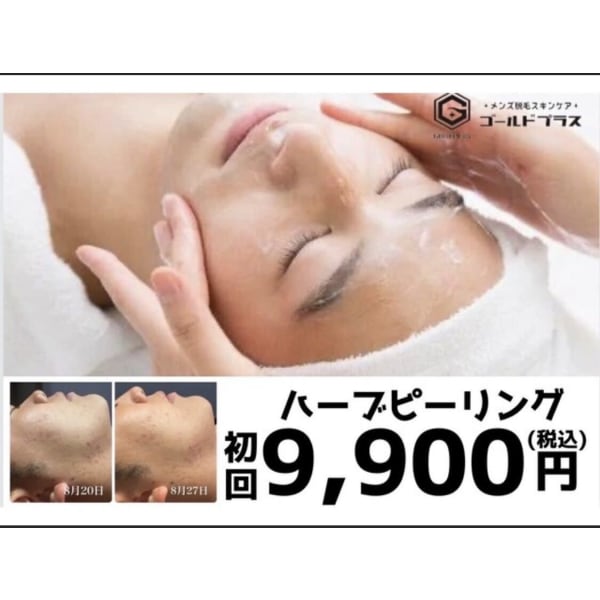 【ハーブピーリング】剥離・ダウンタイムなし◎12800→9900円♪