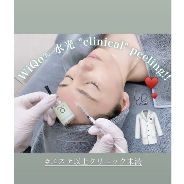 【驚きハリツヤ透明感】Wiqo水光ピール＋冷却＋美容液導入¥15800⇒¥14800