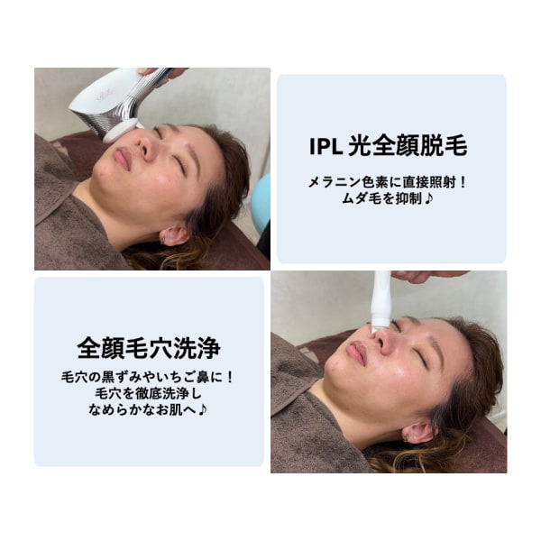 【毛穴洗浄+全顔光脱毛】ツルツル☆毛穴もムダ毛もキレイに♪黒ずみ鼻にも○