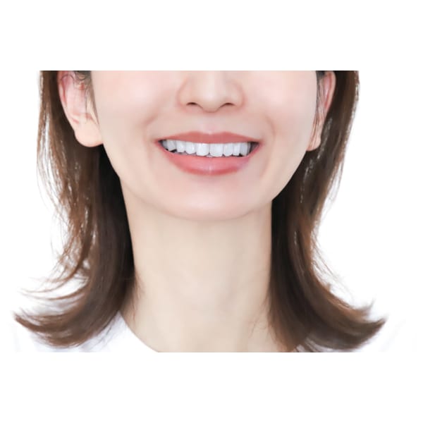 【矯正後・矯正中の方限定】矯正割！！30分照射☆￥500引き￥2,470！