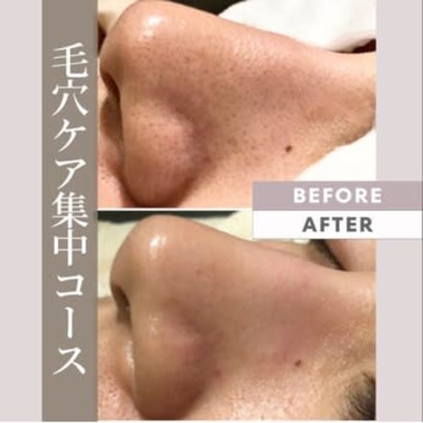 【SNSでも話題の韓国式毛穴ケア】Face60分☆14300円→7700円