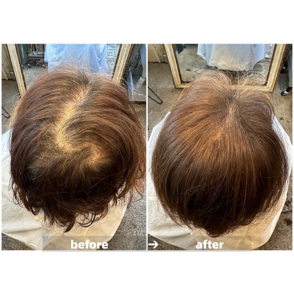 女性人気No.1【育毛促進・リフトアップ・小顔効果・】真空含浸ヘッドスパ　