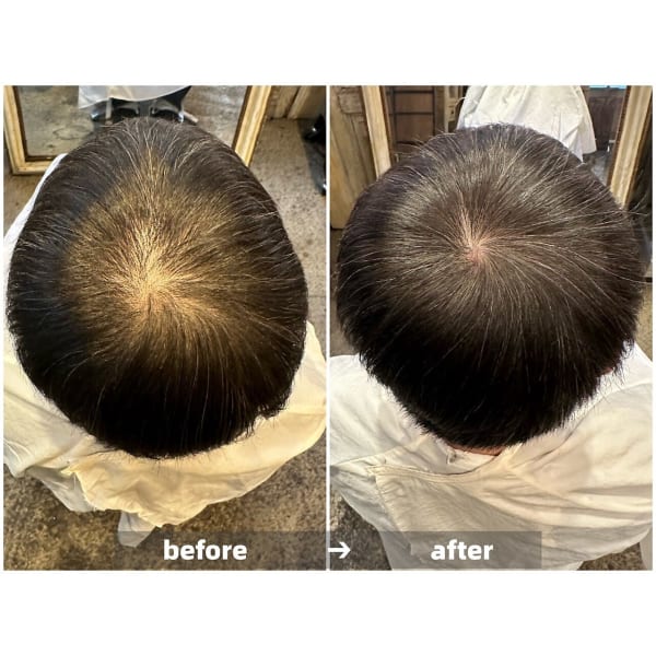 男性人気No.1【育毛促進・頭皮ケア・髪のコシUP】真空含浸ヘッドスパ　