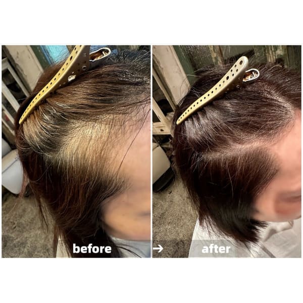 【白髪改善・育毛促進・髪のコシUP】真空含浸ヘッドスパ