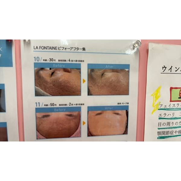 道内初上陸ラフォンテ ドライピーリング