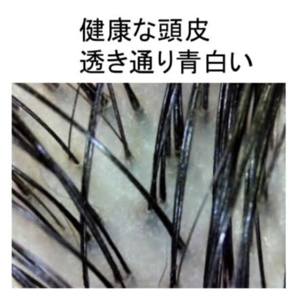 花粉や日差しで疲れた頭皮に最適！！カット＋頭皮ケア