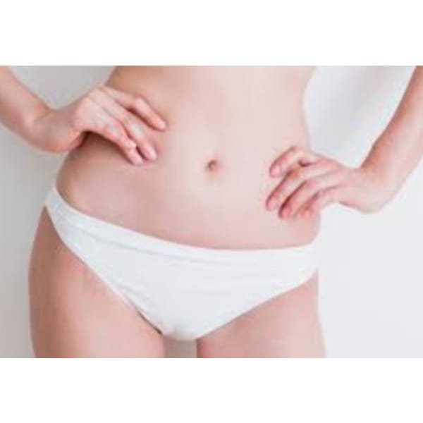 女性VIO脱毛(WAX脱毛+光脱毛)通常1回¥5,000でお試し回数:1回