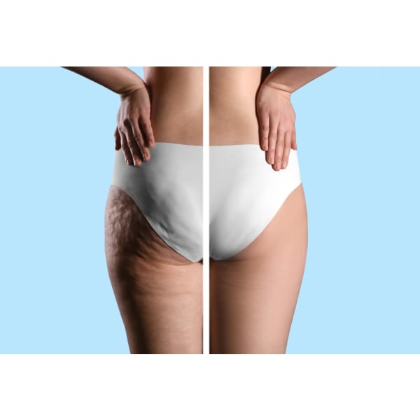 【ヒップ・太もも集中痩身】すらりと伸びる美脚へ!目指せ-10cm!¥2,980