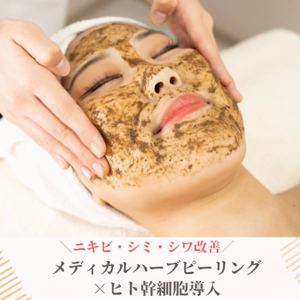 人気NO1【本気の肌質改善】ハーブピーリング×ヒト幹細胞ポレーション導入 ¥19800→￥13200