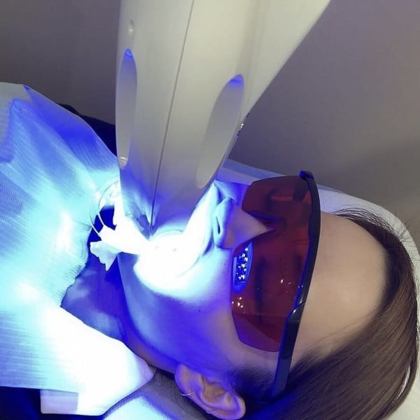 【1~2トーンアップ】着色汚れをホワイトニング!セルフホワイトニング《8分照射×2回》