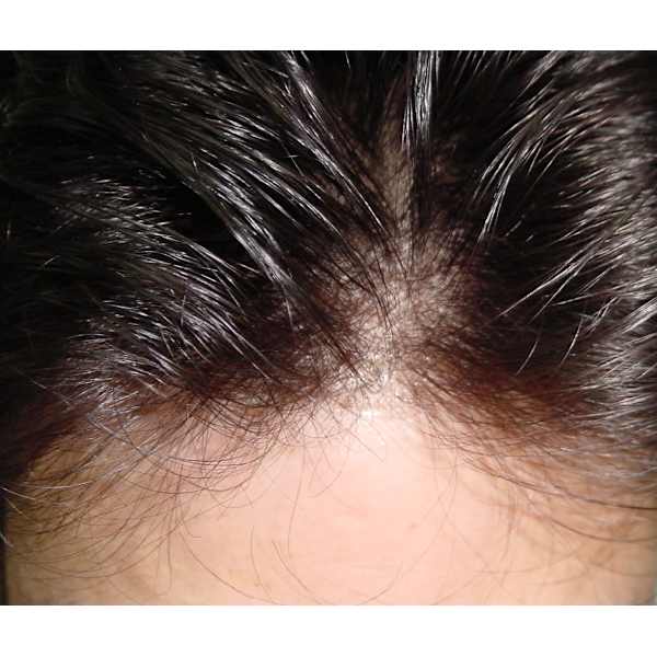 初回他社、貼付け式、編み込み式メンテナンス歓迎