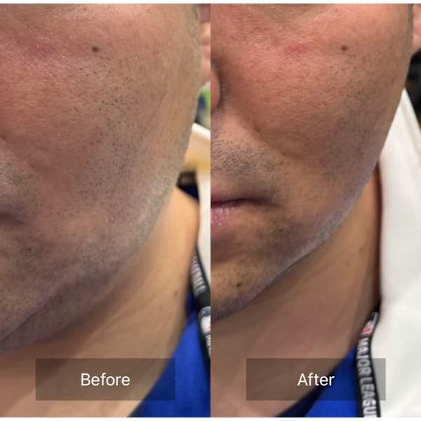 カット＋頭皮パック＋デコルテ（肩より上）のマッサージ