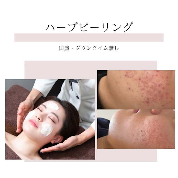 Open記念［ゴワつき・ニキビ気になる方へ］ハープピーリング¥8800/ジェルエステ＋ラテ無料 