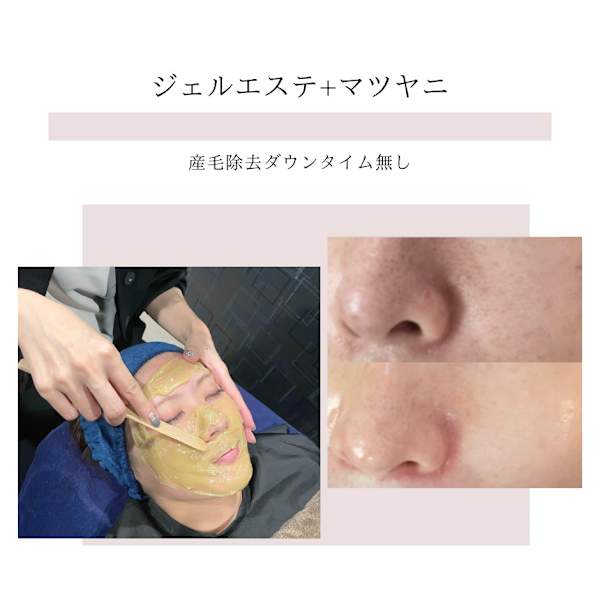 OPEN記念【毛穴・ツヤ／気になる方へ】ジェルエステ＋マツヤニWAX★2回コース！