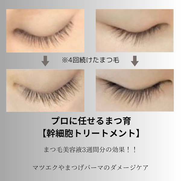 まつ毛パーマ＆【まつ毛の育毛促進サロン用幹細胞トリートメント】ラッシュリフト