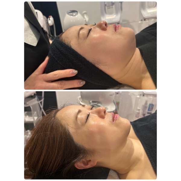 １４周年プラン(120分)水素フェイシャル＆脂肪分解吸引ボディ¥23400→¥19800