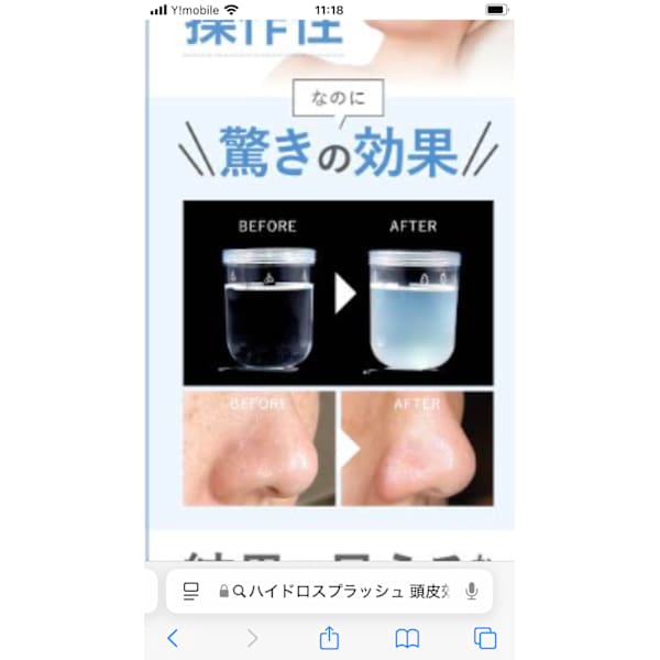 美白ハイドロスプラッシュマジックポットフェイシャル90分￥20400→¥17,400