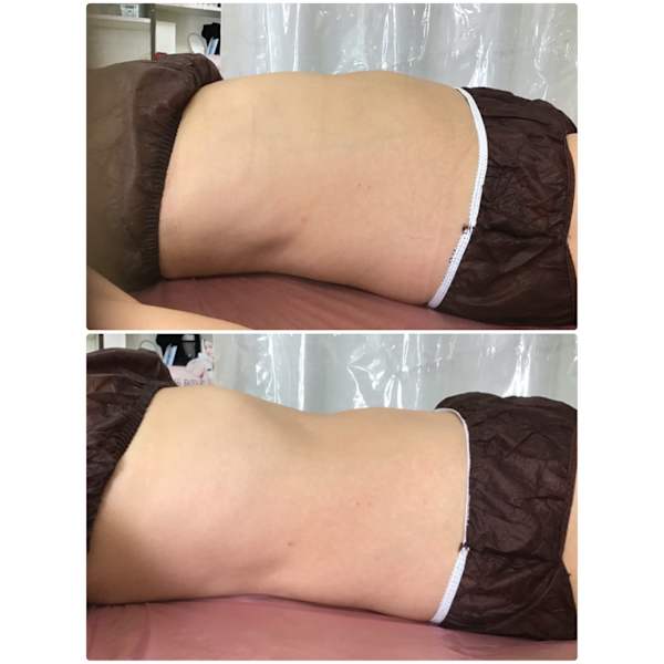 人気NO.1【即実感】スターテック全身90分リンパBODYコース　11,000円【ネット予約限定】