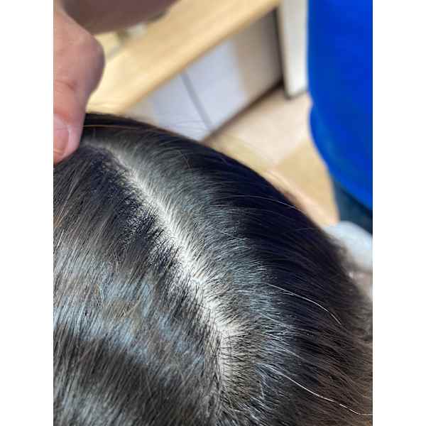 【注目メニュー】人気のダナエ頭皮改善ヘッドスパに高濃度のヒト幹細胞培養美容液を組み込んだコース