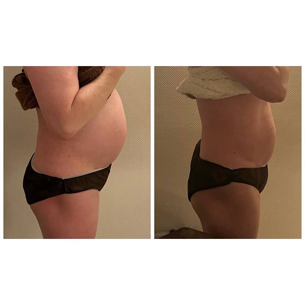 【痩身人気NO.1】最速ダイエット（全身）でマイナス11キロ、体脂肪率マイナス10％達成しました！