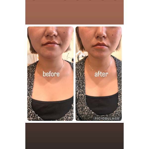 【協会認定講師・レディース限定】 エメラルド式 耳つぼリフレクソロジー