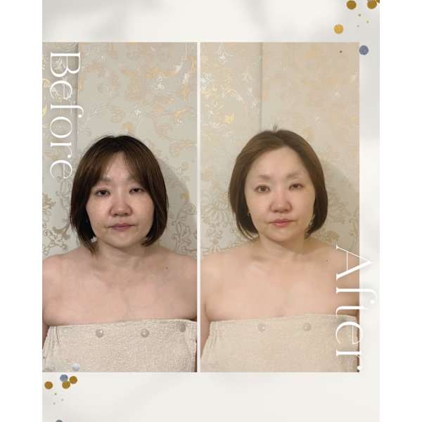 【初回】<秋から小顔！＞シャープフェイス小顔矯正＋ヘッドスパ＋首肩オイルリンパ　60分