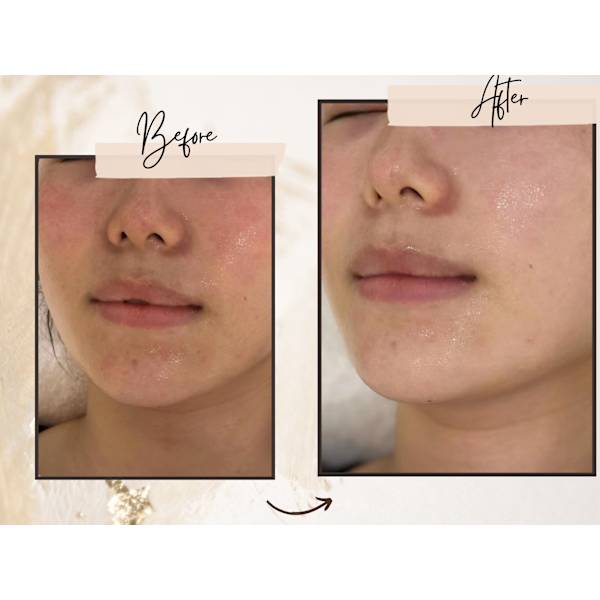 【期間限定】水光肌スペシャルケア￥7700