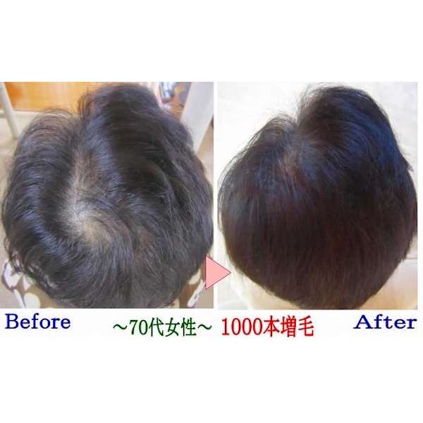 増毛エクステ1000本《オープンキャンペーン20%off》