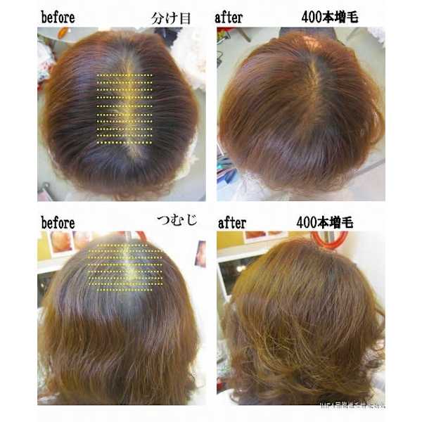 増毛エクステ400本《オープンキャンペーン20%off》