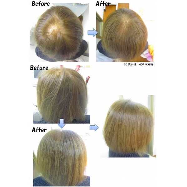 増毛エクステ300本《オープンキャンペーン20%off》