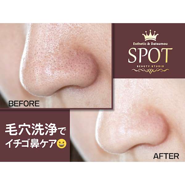 初回限定【毛穴クリアコース♪】クレンジングこみ毛穴洗浄　¥7,000→¥3,500