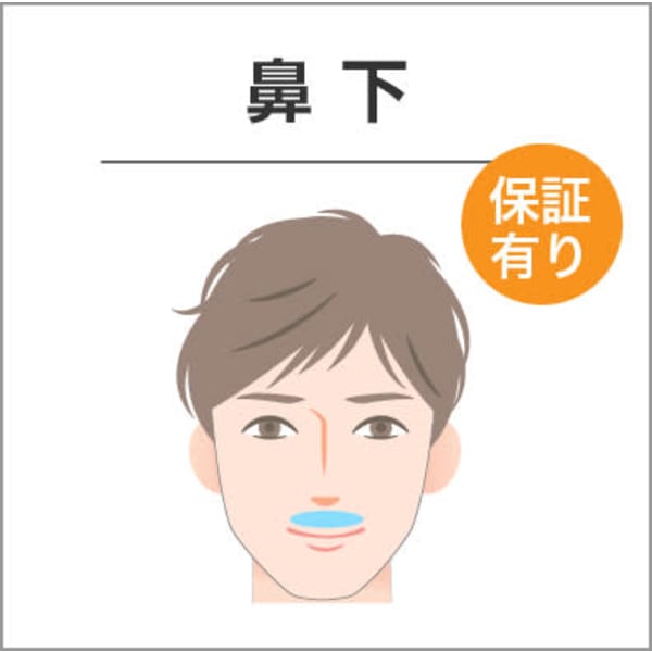 部分ヒゲ脱毛 鼻下