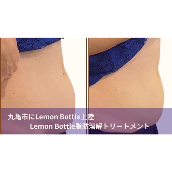 【部分痩せしたい方へ】丸亀市上陸!レモンボトルでボディの脂肪分解痩せ 特別価格 14,800円