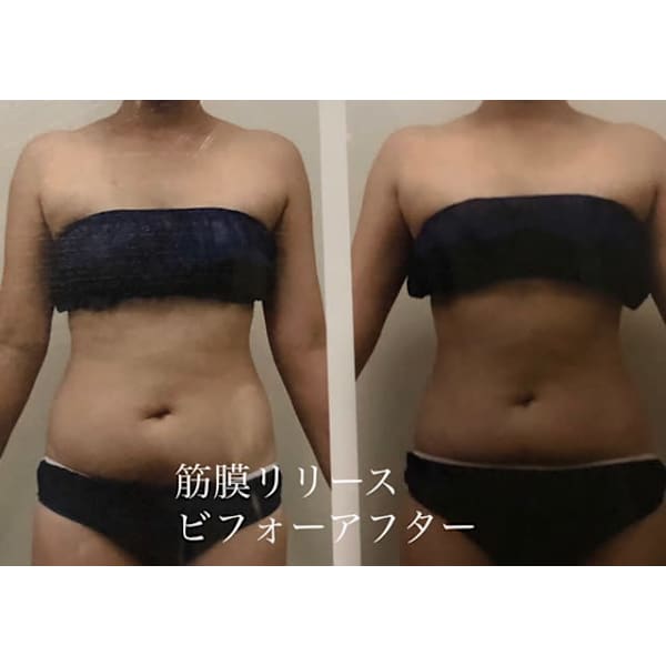 【話題沸騰】 全身スリムダウン！！☆筋膜セラピー 120分　☆筋膜リリース