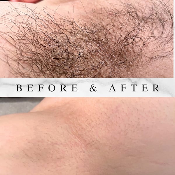 脇脱毛など☆選べるSパーツ2回お試しコース 脇や指、おへそ回りなど気になる部分に♪