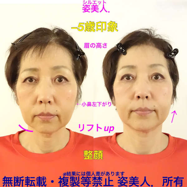 📢人気No1📢全身矯正＋小顔矯正＋ヘッド筋膜リリース＋食いしばり＋歪みチェック70分