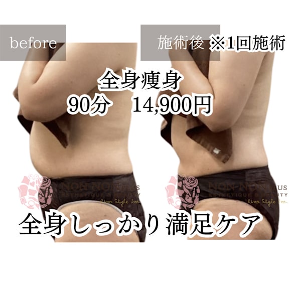 【1回でも変化実感◎】結果重視の本格全身痩身プログラム◆90分初回14,900円