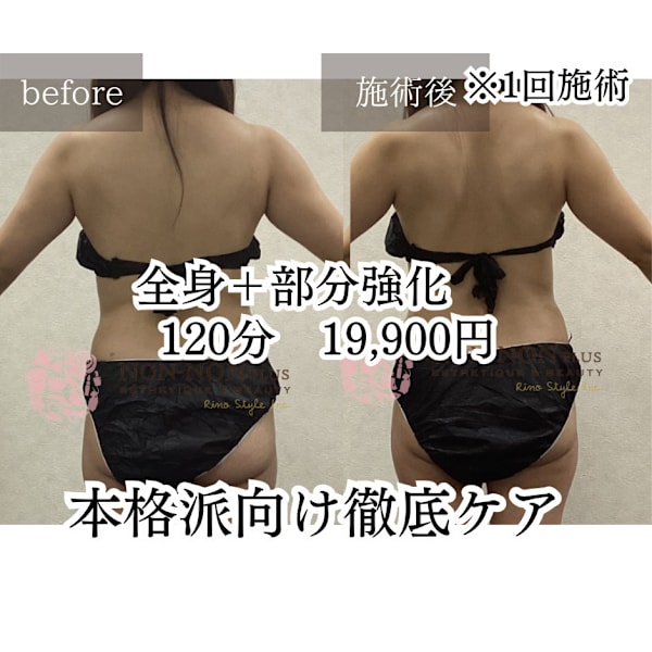 【痩身人気NO.1】驚きの変化!全身痩身×マシンプログラム◆120分初回19,900円