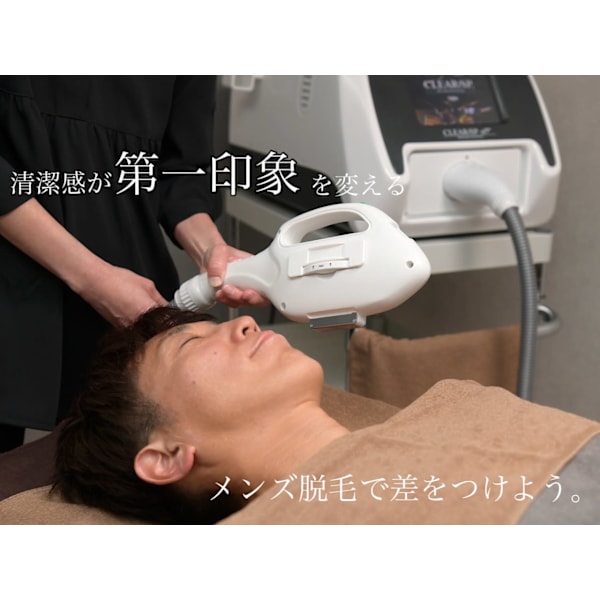 メンズひげ脱毛（首まで含む）
