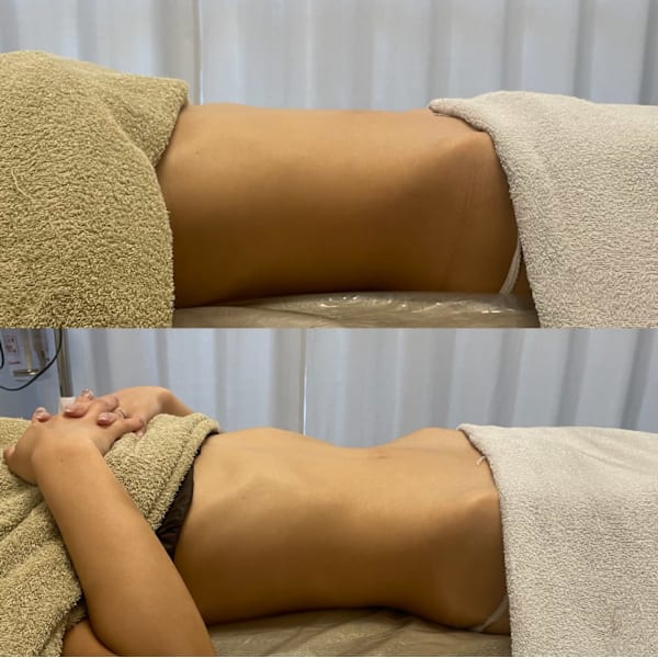 内臓下がってない？便秘改善🔥ぽっこり下腹も腸もみでお腹痩せ◎1回で変化実感！腸もみ+骨盤調整50分